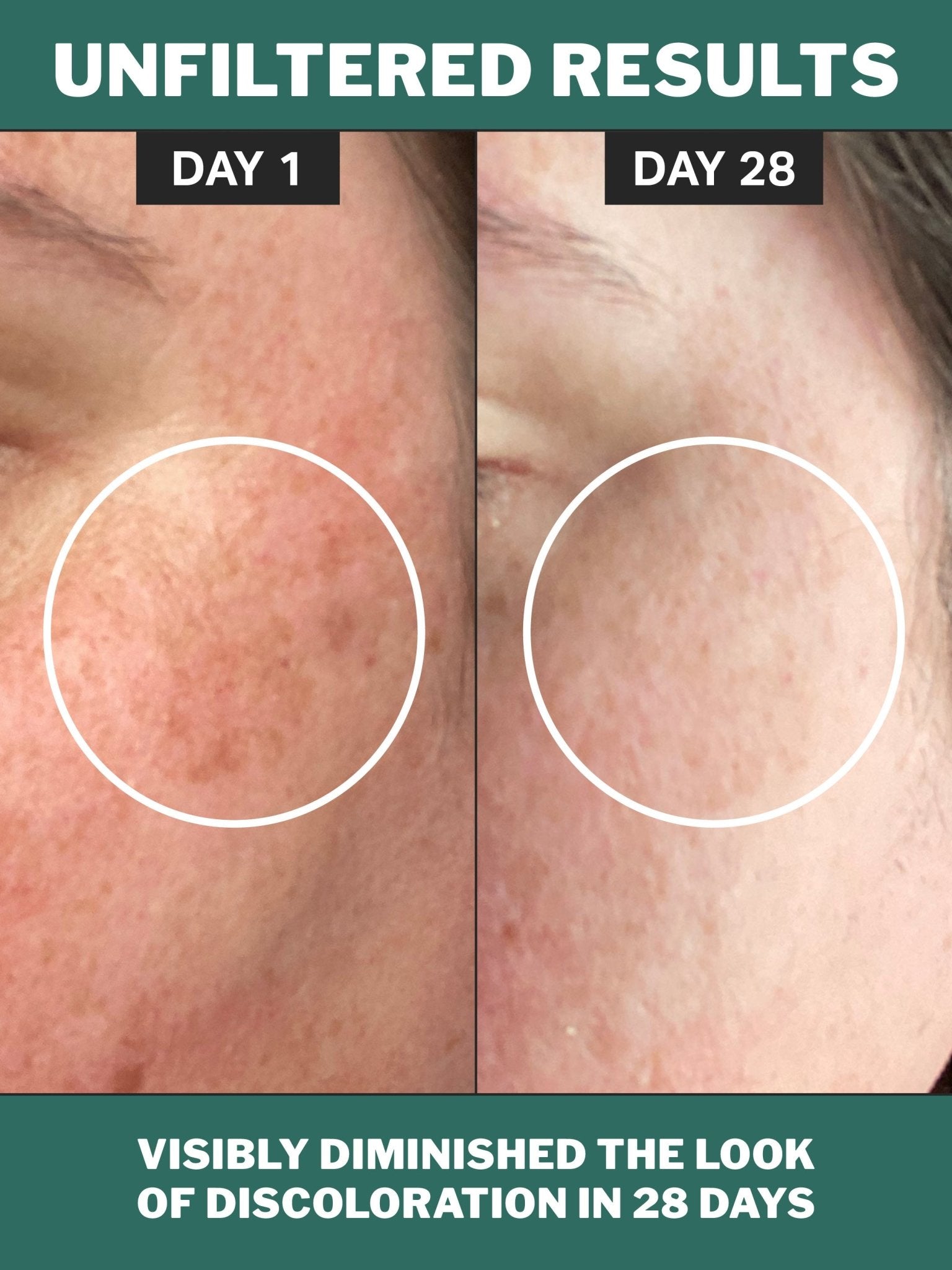 chlorophyll discoloration serum - cocokind
