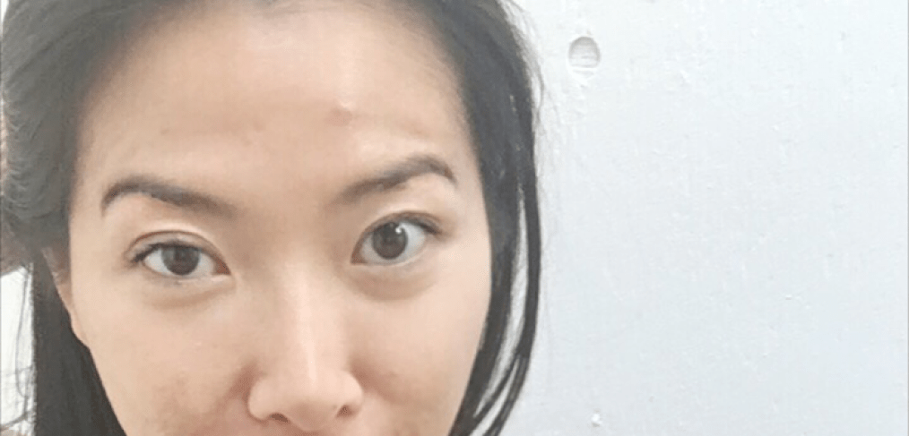 leaning into…hormonal acne? stop fighting and learn how to live with it - cocokind