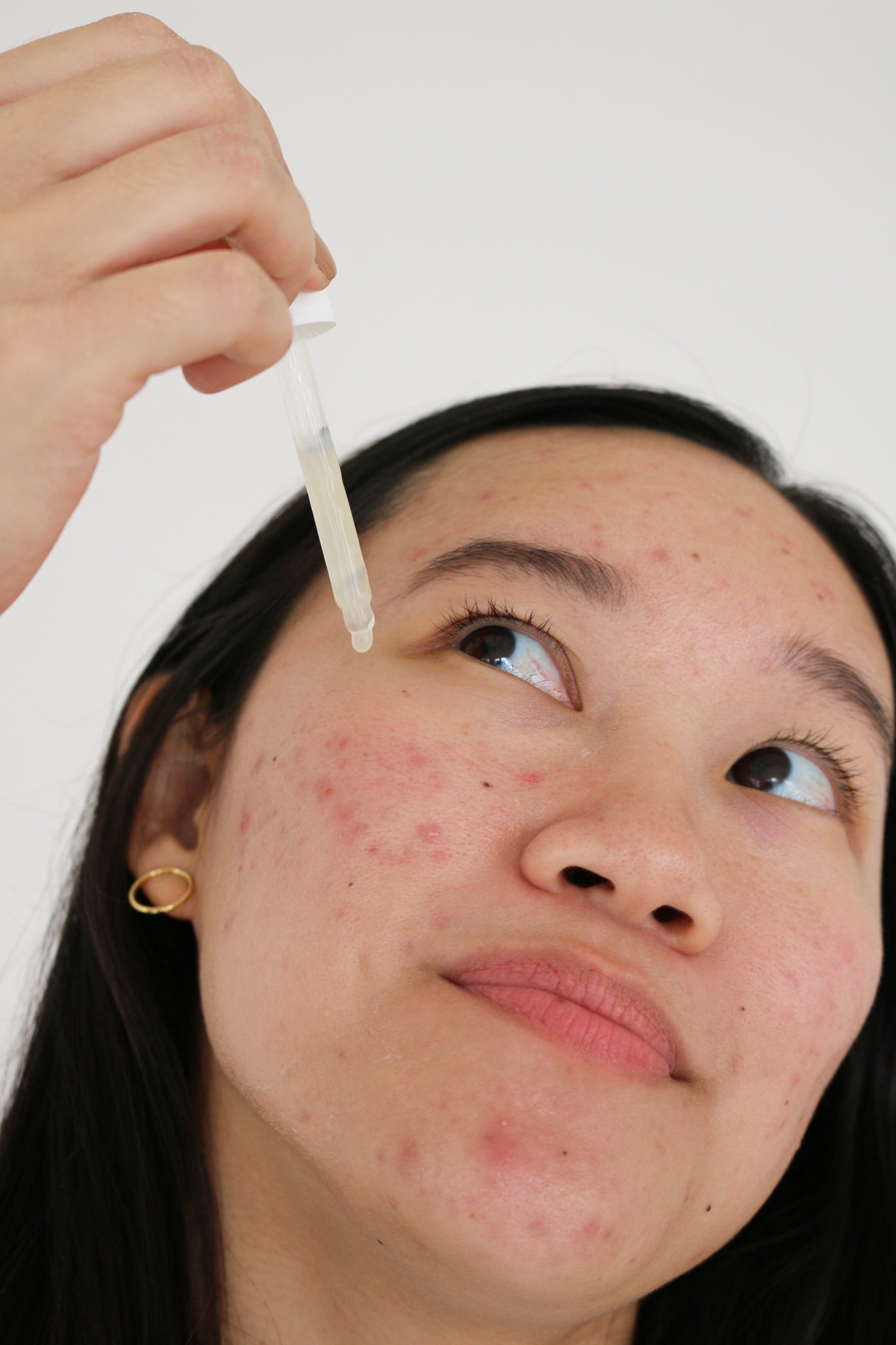 probiotic acne serum *FAQ* - cocokind